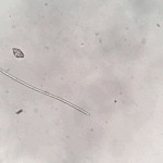 Go home Dinoflagellate, you’re drunk