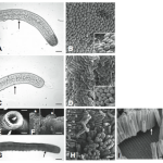 Marine nematodes have a microbiome too (and it’s way cooler than yours)