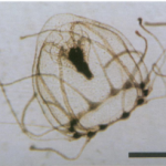Are Jellyfish Immortal?
